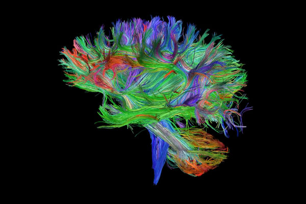 Building Brain Pathways by Brenton Hordacre