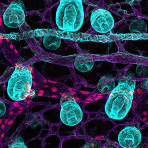 Hairy worms by Dr Genevieve Secker