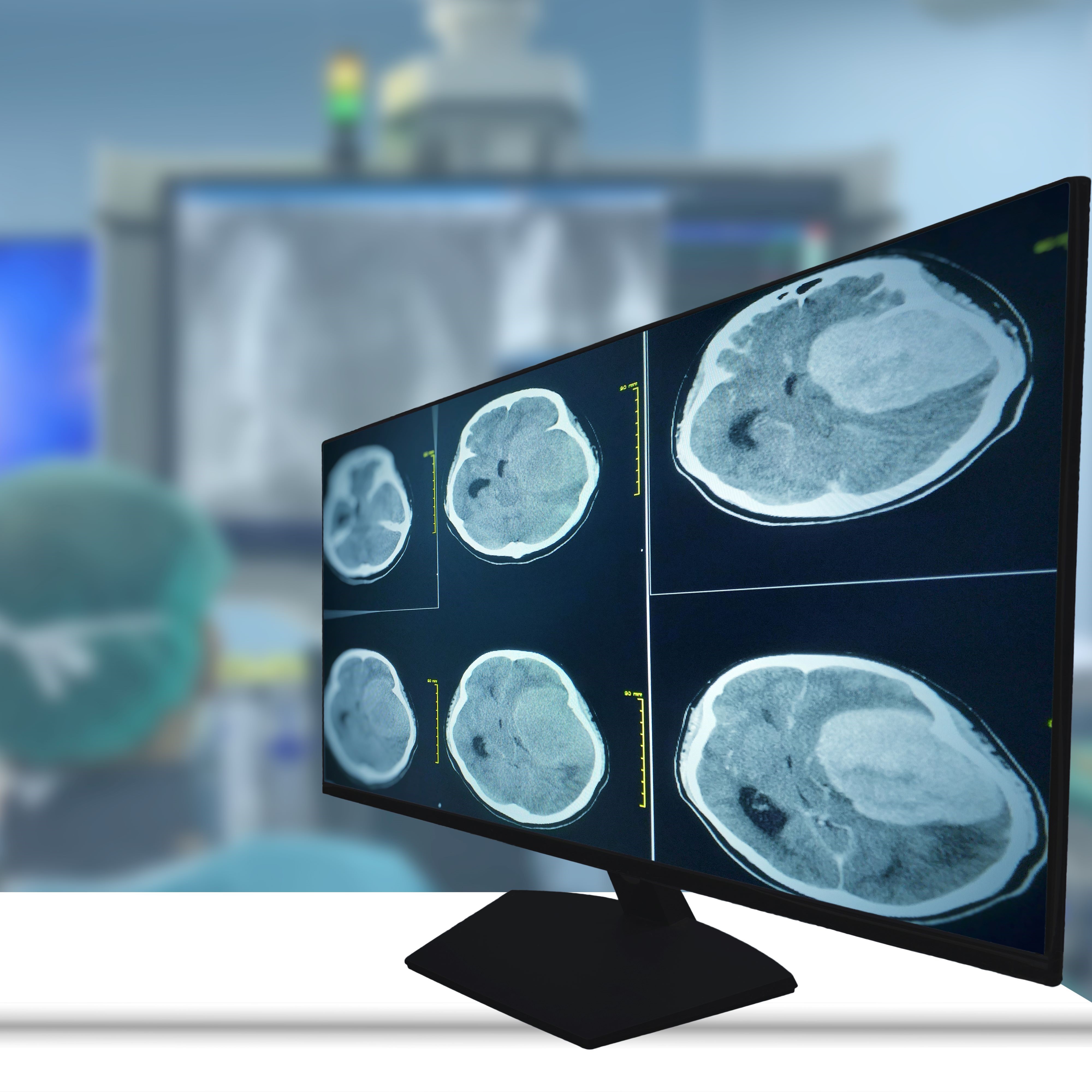 Glioblastoma - 500x500.jpg