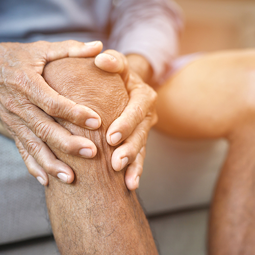 A man holding his sore knee