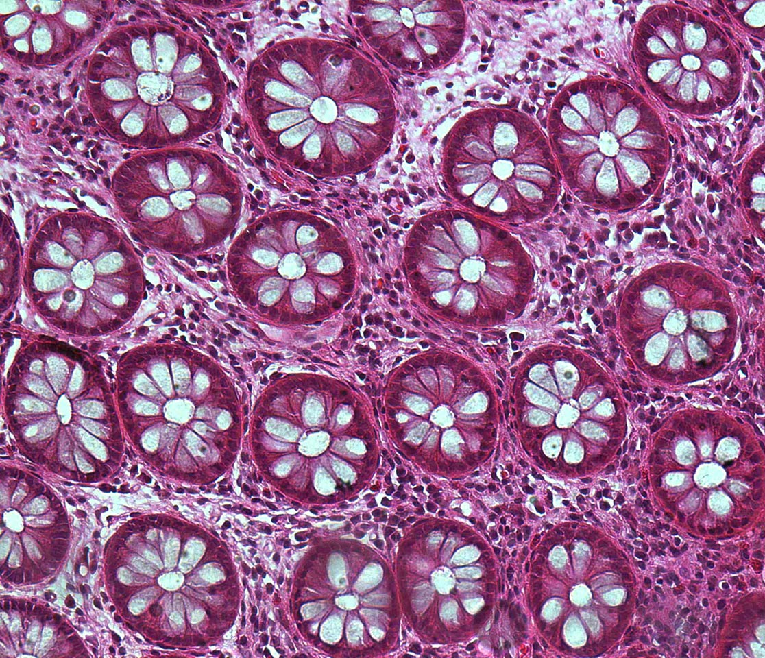 2016 - People's Choice Award - Healthy Blossom - Dr Zlatko Kopecki, Research Fellow, Future Industries Institute