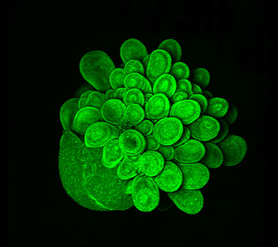 Last year&rsquo;s winner A blooming mini-brain by Oksdath Mansilla.